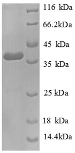 Greater than 90% as determined by SDS-PAGE.Recombinant Human Tenascin (TNC) Protein (His)