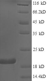 Greater than 90% as determined by SDS-PAGE.Recombinant Human Bis (FHIT) Protein (His)
