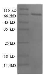 Greater than 90% as determined by SDS-PAGE.Recombinant Human Paired Box Protein Pax-2 (PAX2) Protein (GST)