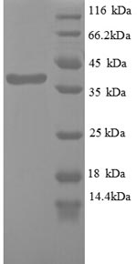 Greater than 90% as determined by SDS-PAGE.Recombinant Human Wilms Tumor Protein (WT1) Protein (His)