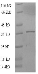 Greater than 90% as determined by SDS-PAGE.Recombinant Human Proliferation Marker Protein Ki-67 (MKI67) Protein (His)