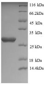 Greater than 90% as determined by SDS-PAGE.Recombinant Human Ubiquitin Carboxyl-Terminal Hydrolase Isozyme L1 (UCHL1) Protein (His)