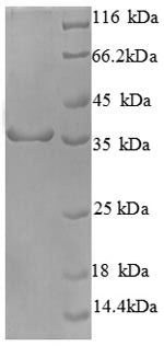 Greater than 90% as determined by SDS-PAGE.Recombinant Human Cyclin-Dependent Kinase 4 (CDK4) Protein (His)