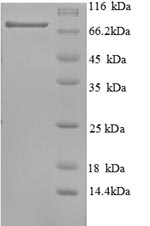 Greater than 90% as determined by SDS-PAGE.Recombinant Human Tumor Protein 63 (TP63) Protein (His)