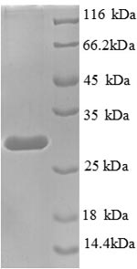 Greater than 90% as determined by SDS-PAGE.Recombinant Human Transcription Termination Factor 1 (TTF1) Protein (His)