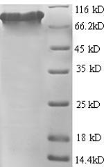 Greater than 90% as determined by SDS-PAGE.Recombinant Human Glutamate Carboxypeptidase 2 (FOLH1) Protein (His)