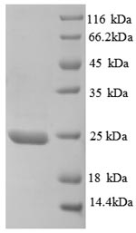 Greater than 90% as determined by SDS-PAGE.Recombinant Human Metalloproteinase Inhibitor 3 (TIMP3) Protein (His)