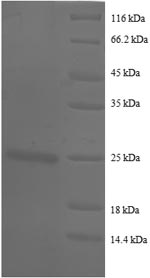 Greater than 90% as determined by SDS-PAGE.Recombinant Human Basigin (BSG) Protein (His)