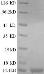 Greater than 90% as determined by SDS-PAGE.Recombinant Human Prostate Stem Cell Antigen (PSCA) Protein (His&His)