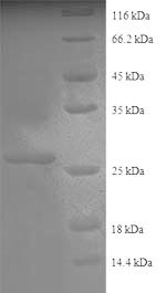 Greater than 90% as determined by SDS-PAGE.Recombinant Human Collagen alpha-2 (COL4A2) Protein (His)