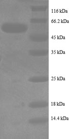 Greater than 90% as determined by SDS-PAGE.Recombinant Human Intestinal-Type Alkaline Phosphatase (ALPI) Protein (His)