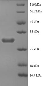 Greater than 90% as determined by SDS-PAGE.Recombinant Human Peptide Yy Protein (PYY) Protein (GST)