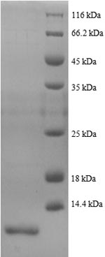 Greater than 90% as determined by SDS-PAGE.Recombinant Human Peptide Yy Protein (PYY) Protein (His)