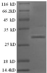 Greater than 90% as determined by SDS-PAGE.Recombinant Human Islet Amyloid Polypeptide Protein (IAPP) Protein (GST)