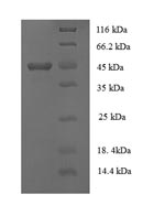 Greater than 90% as determined by SDS-PAGE.Recombinant Human Collagen alpha-1 (COL18A1) Protein (GST)