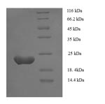 Greater than 90% as determined by SDS-PAGE.Recombinant Human Zinc Finger Protein Gli1 (GLI1) Protein (His)