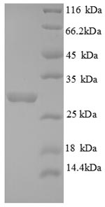 Greater than 90% as determined by SDS-PAGE.Recombinant Human Androgen-Induced Gene 1 (AIG1) Protein (GST)