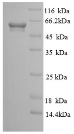 Greater than 90% as determined by SDS-PAGE.Recombinant Human Soluble Calcium-Activated Nucleotidase 1 (CANT1) Protein (GST)