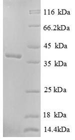 Greater than 90% as determined by SDS-PAGE.Recombinant Human Soluble Calcium-Activated Nucleotidase 1 (CANT1) Protein (His)