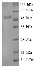 Greater than 90% as determined by SDS-PAGE.Recombinant Human Beta-Enolase (ENO3) Protein (His)