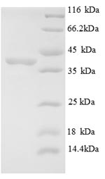 Greater than 90% as determined by SDS-PAGE.Recombinant Human E3 Ubiquitin-Protein Ligase Mib1 (MIB1) Protein (His)
