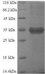 Greater than 90% as determined by SDS-PAGE.Recombinant Human Metalloreductase Steap1 (STEAP1) Protein (GST)