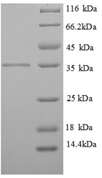 Greater than 90% as determined by SDS-PAGE.Recombinant Human Tropomyosin Beta Chain (TMSB) Protein (His)