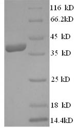 Greater than 90% as determined by SDS-PAGE.Recombinant Human Annexin A1 (ANXA1) Protein (His)