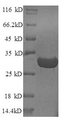 Greater than 90% as determined by SDS-PAGE.Recombinant Arabidopsis Thaliana Chorismate Mutase, Chloroplastic (CM1) Protein (His)