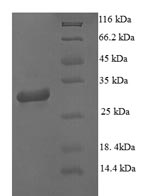 Greater than 90% as determined by SDS-PAGE.Recombinant Human Microtubule-Associated Protein 1S (MAP1S) Protein (His)