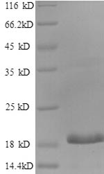 Greater than 90% as determined by SDS-PAGE.Recombinant Human Ccaat/Enhancer-Binding Protein Gamma (CEBPG) Protein (His)