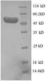 Greater than 90% as determined by SDS-PAGE.Recombinant Human Proteasome Activator Complex Subunit 3 (PSME3) Protein (GST)