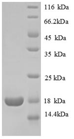 Greater than 90% as determined by SDS-PAGE.Recombinant Human 60S Ribosomal Protein L31 (RPL31) Protein (His)