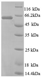 Greater than 90% as determined by SDS-PAGE.Recombinant Human Rna-Binding Protein Ro60 (TROVE2) Protein (His)