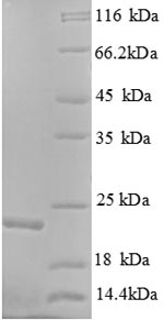 Greater than 90% as determined by SDS-PAGE.Recombinant Human Gtpase Kras (KRAS) Protein (His)