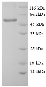 Greater than 90% as determined by SDS-PAGE.Recombinant Lemna Minor Atp Synthase Subunit Beta, Chloroplastic (ATPB) Protein (His)