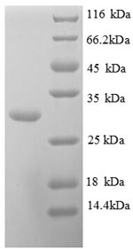Greater than 90% as determined by SDS-PAGE.Recombinant Human Kallikrein-10 (KLK10) Protein (His)