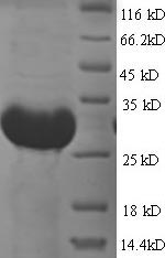 Greater than 90% as determined by SDS-PAGE.Recombinant E.Coli Vitamin B12-Binding Protein (BTUF) Protein (His)