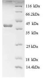 Greater than 90% as determined by SDS-PAGE.Recombinant Human Advanced Glycosylation End Product-Specific Receptor (AGER) Protein (His)