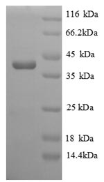 Greater than 90% as determined by SDS-PAGE.Recombinant Saccharomyces Cerevisiae Homocysteine S-Methyltransferase 1 (MHT1) Protein (His)