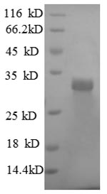 Greater than 90% as determined by SDS-PAGE.Recombinant Human Laminin Subunit Beta-2 (LAMB2) Protein (His)