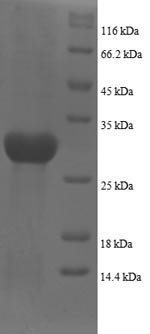 Greater than 90% as determined by SDS-PAGE.Recombinant Human Plexin-A1 (PLXNA1) Protein (His)