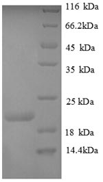 Greater than 90% as determined by SDS-PAGE.Recombinant Human Plexin-A1 (PLXNA1) Protein (His)