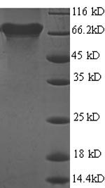 Greater than 90% as determined by SDS-PAGE.Recombinant Helicobacter Pylori Urease Subunit Beta (UREB) Protein (His)