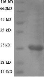 Greater than 90% as determined by SDS-PAGE.Recombinant Helicobacter Pylori Vacuolating Cytotoxin Autotransporter (VACA) Protein (His)