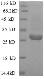 Greater than 90% as determined by SDS-PAGE.Recombinant Helicobacter Pylori Vacuolating Cytotoxin Autotransporter (VACA) Protein (His)
