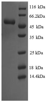 Greater than 90% as determined by SDS-PAGE.Recombinant Saccharomyces Cerevisiae Cystathionine Gamma-Lyase (CYS3) Protein (His)