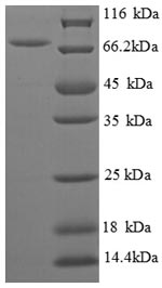 Greater than 90% as determined by SDS-PAGE.Recombinant E.Coli Biosynthetic Arginine Decarboxylase (SPEA) Protein (His)