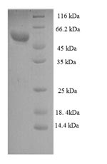 Greater than 90% as determined by SDS-PAGE.Recombinant Human Zona Pellucida Sperm-Binding Protein 3 (ZP3) Protein (GST)