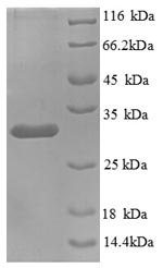 Greater than 90% as determined by SDS-PAGE.Recombinant Human Kininogen-1 (KNG1) Protein (His)
